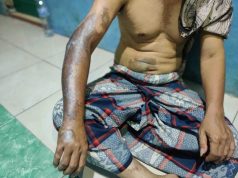 Seorang Marbot Musala di Pekalongan Disiram Air Keras Orang Misterius