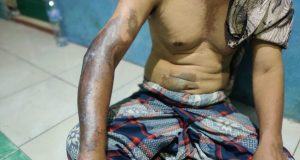 Seorang Marbot Musala di Pekalongan Disiram Air Keras Orang Misterius