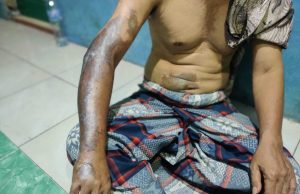 Seorang Marbot Musala di Pekalongan Disiram Air Keras Orang Misterius